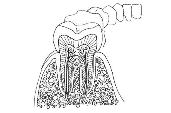 Anatomy of Teeth Embroidery Review